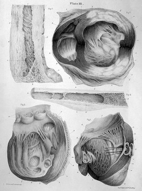 Pathological anatomy : illustrations of the elementary forms of disease / By Robert Carswell.