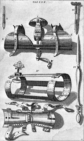 Cheiroplotheke, seu ... Armamentarium chirurgicum : ... Opus posthumum ... in quo tot, tam veterum ac recentiorum instrumenta ab authore correcta, quàm noviter ab ipso inventa, quot ferè hodiè ad usitatas operationes manuales feliciter peragendas requiruntur ... depicta reperiuntur / ... Nunc primum in lucem editum, studio et opera Joannis Sculteti, authoris ... nepotis.