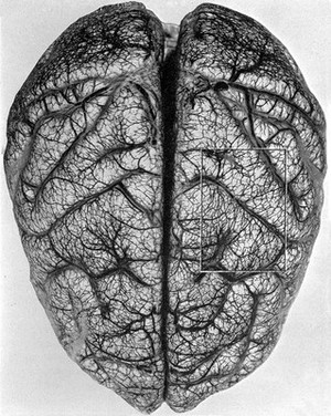 view Arteries and veins of the brain.