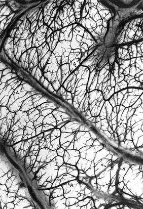 Ateries and veins of the brain.