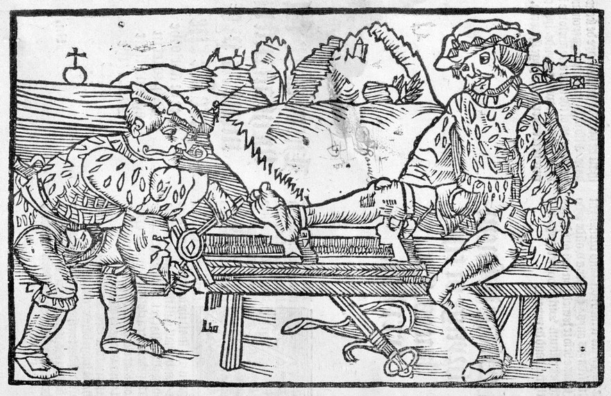 The noble experyence of the vertuous handy warke of surgeri / practysyd & compyled by the moost experte mayster Jherome of Bruynswyke borne ine Straesborowe in Almayne ye whiche hath it fyrst proved and trewly founde by his awne dayly exerycsynge ... Here also shall ye fynde for to cure & hele all wounded membres, and other swellynges ... Item here shall ye fynde also for to make salves, plasters, powders, oyles, and drynkes for woundes.