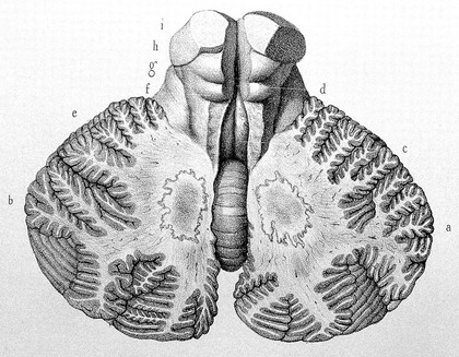 Traité complet de l'anatomie de l'homme comprenant la médecine opératoire ... : avec planches lithographiées ... / par N.H. Jacob.