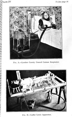 "Breathing machines" and their use in treatment : report of the Respirators (Poliomyelitis) Committee.