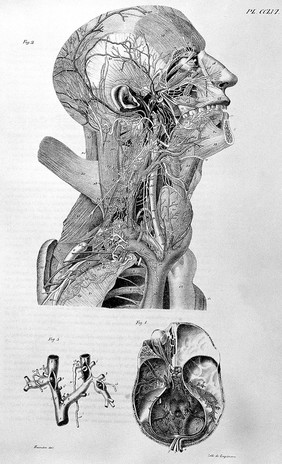 Anatomie de l'homme, ou description et figures lithographiées de toutes les parties du corps humain / par Jules Cloquet.