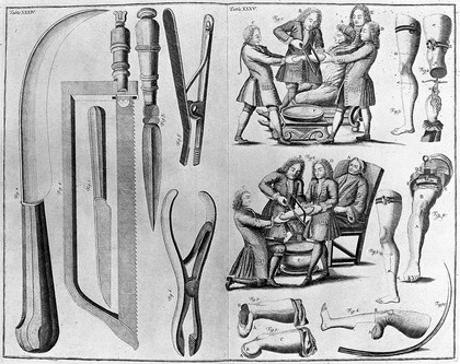 A medicinal dictionary; including physic, surgery, anatomy, chymistry, and botany, in all their branches relative to medicine. Together with a history of drugs ... and an introductory preface, tracing the progress of physic, and explaining the theories which have ... prevail'd in all ages / By R. James.