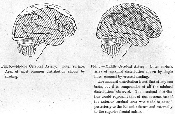 Distribution of middle cerebral artery - 2 diagrams