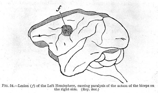 The Functions of the brain / by David Ferrier.