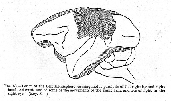 The Functions of the brain / by David Ferrier.