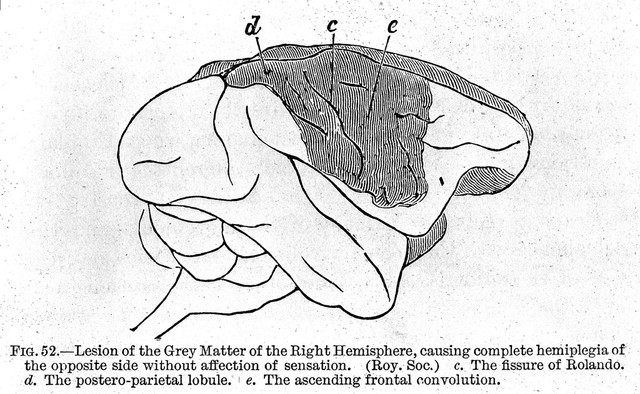 The Functions of the brain / by David Ferrier.