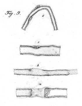 Neurology, 19th century: cell of Schwann.