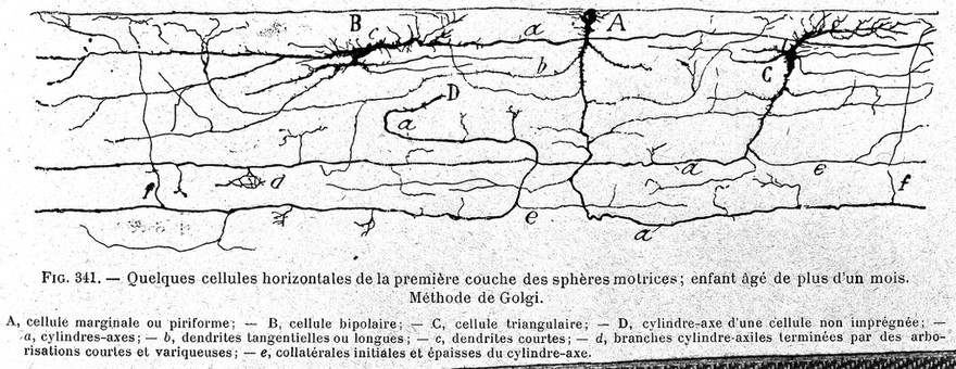 Cerebral cortex in a child.