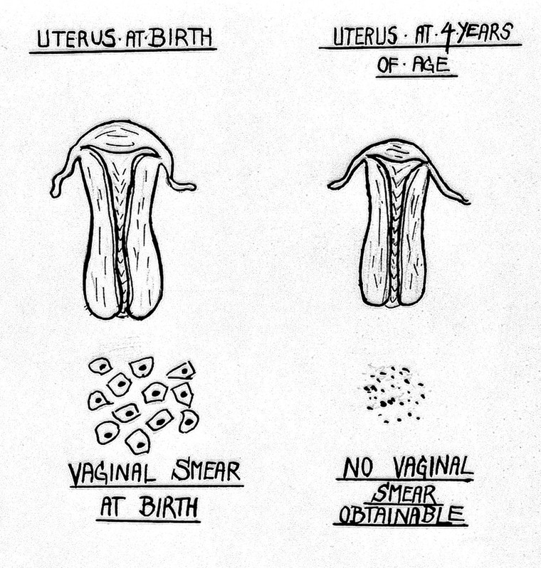 Uterus Size Chart