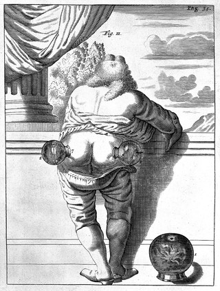 Exercitationes practicae circa medendi methodum, auctoritate, ratione, observationibusve plurimis confirmatae ac figuris illustratae ... / [Frederick Dekkers].