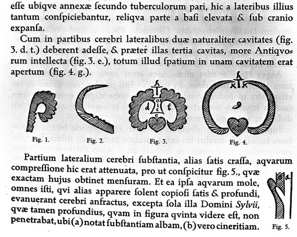 Nicolai Stenonis Opera philosophica / edited by Vilhelm Maar, at the expense of the Carlsbergfond.