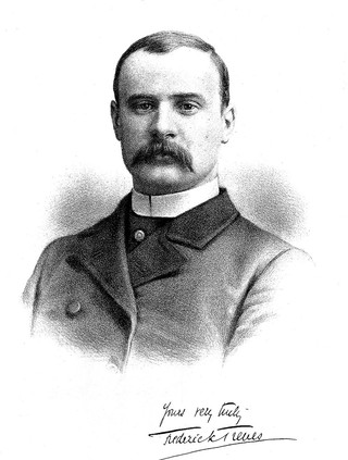 Sir Frederick Treves. Lithograph, 1884.