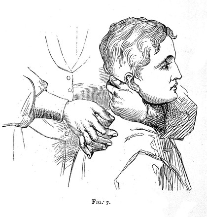 On bone-setting (so called), and its relation to the treatment of joints crippled by injury, rheumatism, inflammation, &c. &c / by Wharton P. Hood.