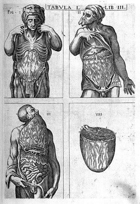 Anatomie, oft levende beelden vande deelen des menschelicken lichaems: met de verclaringhe van dien, inde Neder-duytsche spraecke / [Juan Valverde].