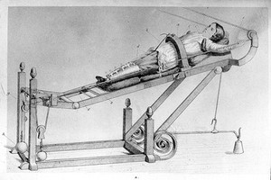 view Carnochan, orthopaedics apparatus