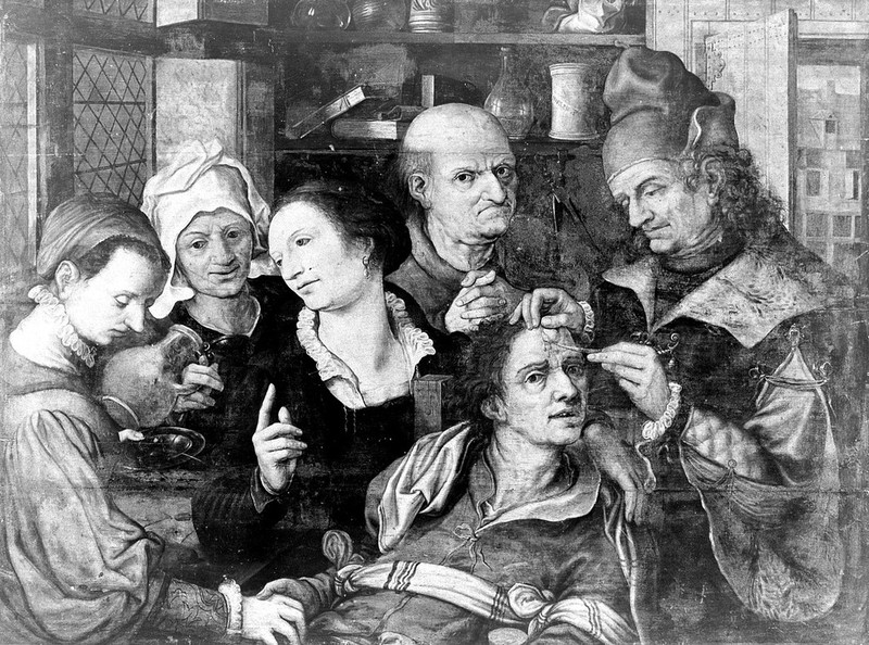 Operation for 'pierre de tete', after Hemessen, 16thC., by Pieter Huys
