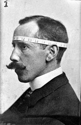 The phrenologist Bernard Hollander illustrating with his own head his system of cranial measurements. Photographs, c. 1902.