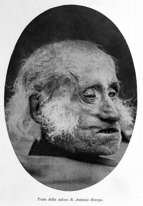 Death head of Antonio Scarpa