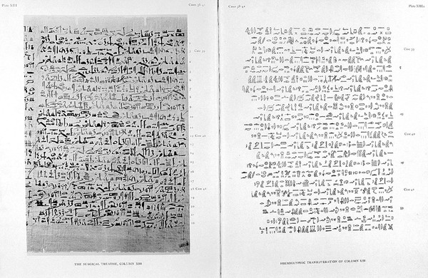 The Edwin Smith surgical papyrus : published in facsimile and hieroglyphic transliteration with translation and commentary in two volumes / by James Henry Breasted.