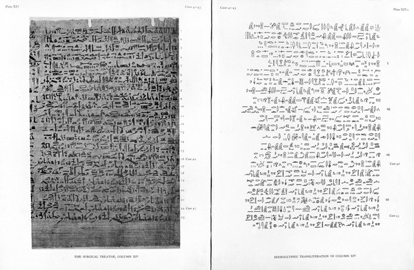 The Edwin Smith surgical papyrus : published in facsimile and hieroglyphic transliteration with translation and commentary in two volumes / by James Henry Breasted.