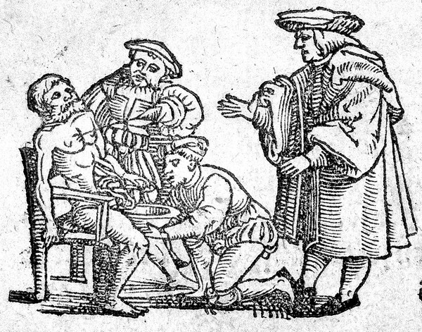 Bloodletting, 16th Century