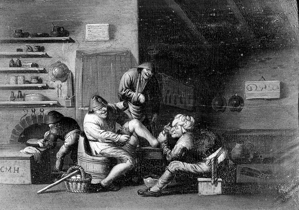 A surgeon operating on a man's foot. Oil painting attributed to Cornelis Mahu after Adriaen van Ostade.