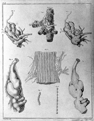 Lectures on comparative anatomy in which are explained the preparations in the Hunterian collection ... To which is subjoined: Synopsis systematis regni animalis nunc primum ex ovi modificationibus propositi. [Supplement] / By Sir Everard Home, bart.