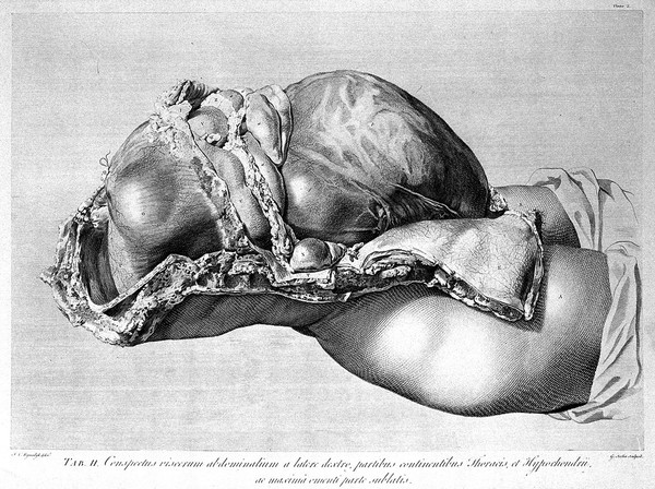 Anatomia uteri humani gravidi tabulis illustrata ... The anatomy of the human gravid uteris exhibited in figures / [William Hunter].