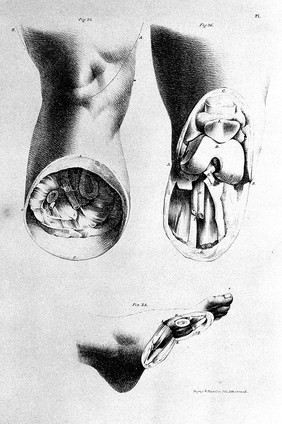 Operative surgery. Maingault's illustrations of the different amputations performed on the human body ... / with alterations and practical observations: by William Sands Cox.