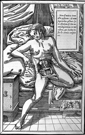 Andreae Vesalii Bruxellensis, scholae medicorum Patauinae professoris De humani corporis fabrica libri septem.