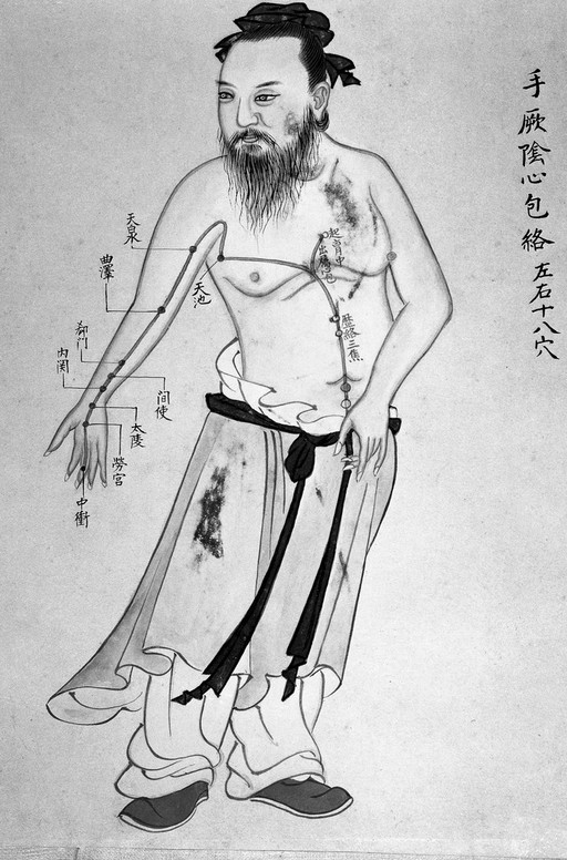 Chinese Acupuncture chart, 18th century.