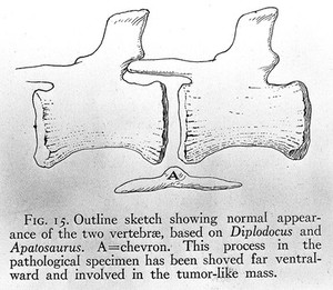 view Outline sketch showing normal appearance of the two vertebrae, based on Diplodocus and Apatosaurus