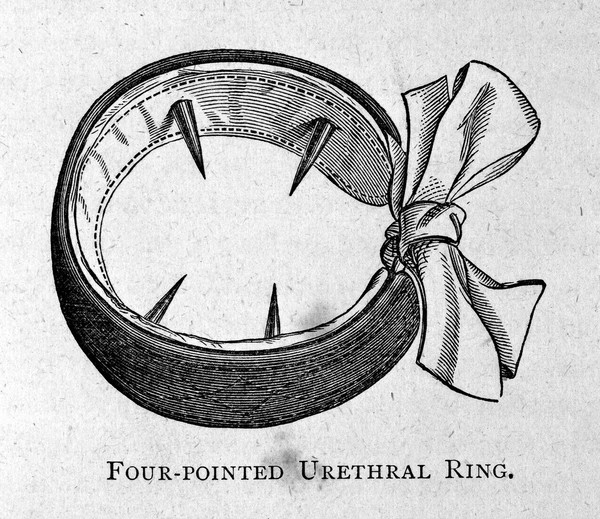 On the pathology and treatment of spermatorrhœa / by J.L. Milton.