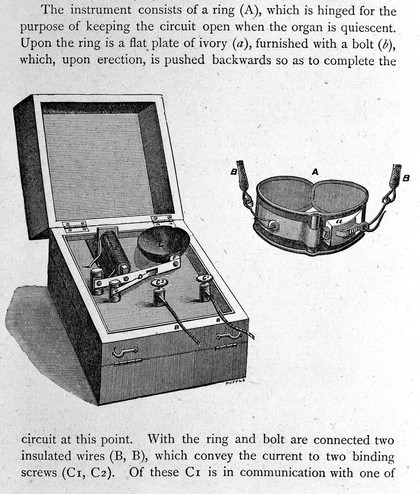 On the pathology and treatment of spermatorrhœa / by J.L. Milton.
