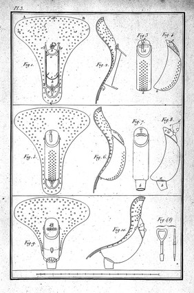 Considérations sur les hernies abdominales, sur les bandages herniaires rénixigrades et sur de nouveaux moyens de s'opposer à l'onanisme / [Guillaume Jalade-Lafond].