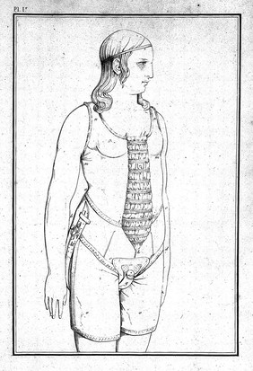 Considérations sur les hernies abdominales, sur les bandages herniaires rénixigrades et sur de nouveaux moyens de s'opposer à l'onanisme / [Guillaume Jalade-Lafond].