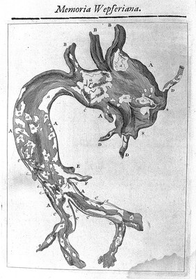 Johann Jakob Wepfer | Wellcome Collection