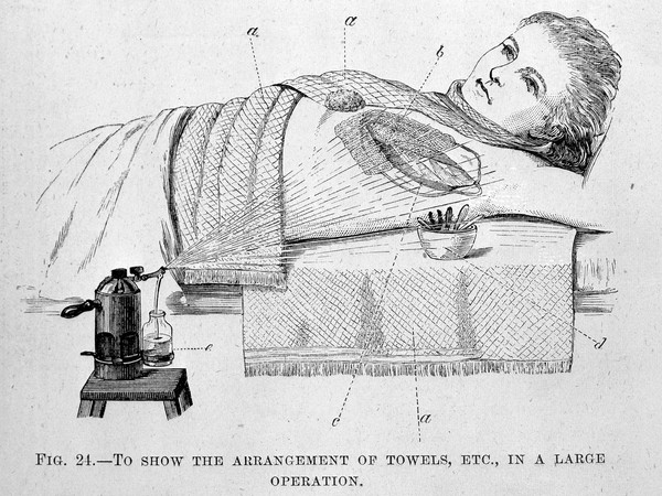 Antiseptic surgery : its principles, practice, history and results / by W. Watson Cheyne.