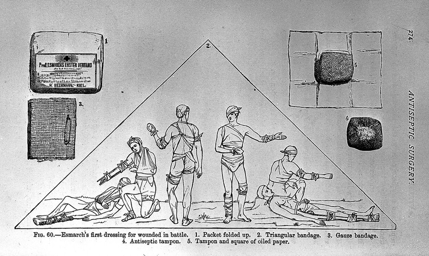 Antiseptic surgery : an address delivered at St Thomas's Hospital with the subsequent debate to which are added a short statement of the theory of the antiseptic method, a description of the materials employed in carrying it out, and some applications of the method to operations and injuries in different regions of the body, and to wounds received in war / by William MacCormac.