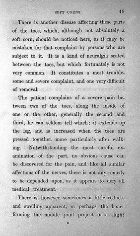 A treatise on corns, bunions, the diseases of nails, and the general management of the feet / By Lewis Durlacher.