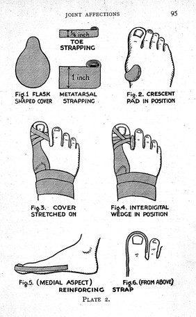 Practcal chiropody, toe illustration.