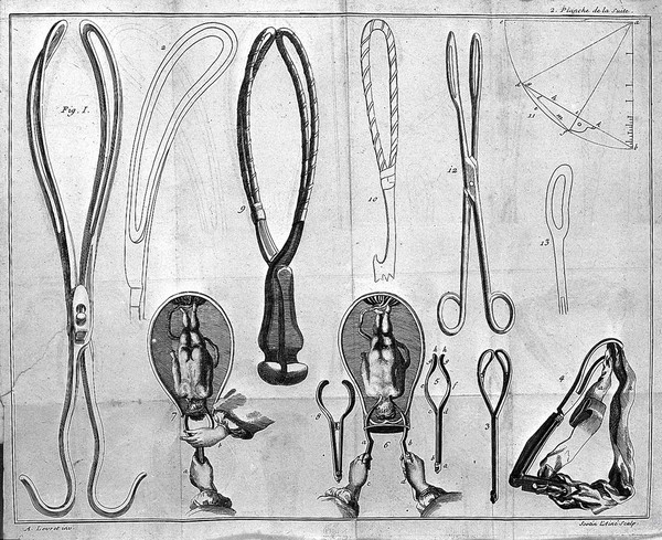 Suite des Observations sur les causes et les accidens de plusieurs accouchemens laborieux / [A. Levret].