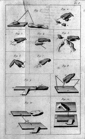 Expériences sur le galvanisme et en général sur l'irritation des fibres musculaires et nerveuses / de Frédéric-Alexandre Humboldt; Traduction de l'allemand [by Gruvel or Gravel], publiée, avec des additions, par J. Fr. N. Jadelot.