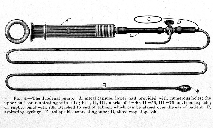 The duodenal tube and its possibilities / by Max Einhorn.