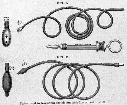 The duodenal pump.