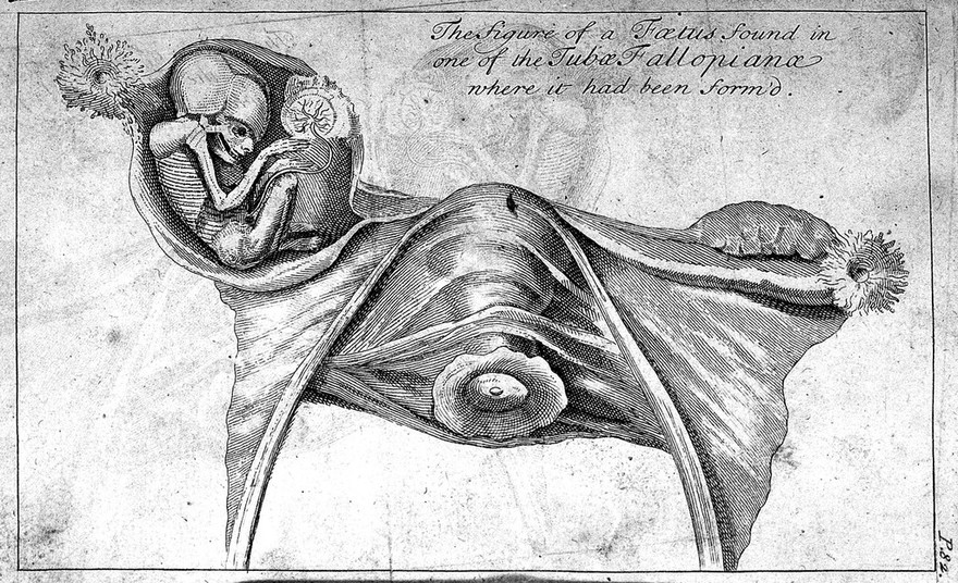 A general treatise of midwifery. Faithfully translated from the French ... / [Pierre Dionis].