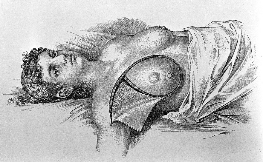 Surgical papers / by William Steward Halsted.